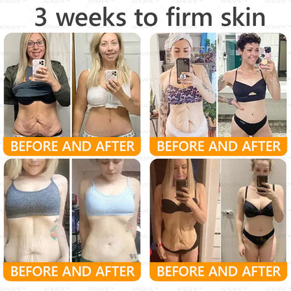 Clinically Proven Formula:✨ APKAPK® Bee venom Comprehensive Cream 🔥 Sagging Skin, Fine Lines, Loss of Firmness, Flat Bust, Drooping Hips, and More