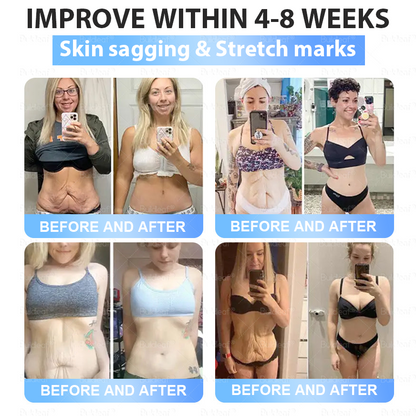 [Last Day Promotion 60% OFF] 💎Buildleaf® Tirzepatide Slimming & Health Nano Microneedle Patch 🇺🇸👩‍⚕️(Zero Pain, 24/7 Release | Lose 20lbs FAST | 90%Sugar DropI) (Copy)
