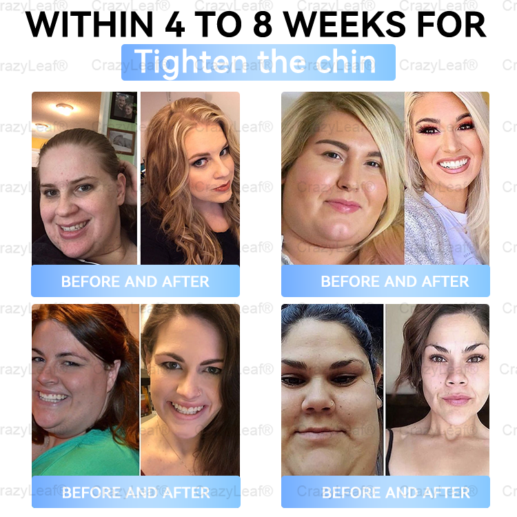 [Last Day Promotion 60% OFF] 💎Buildleaf® Tirzepatide Slimming & Health Nano Microneedle Patch 🇺🇸👩‍⚕️(Zero Pain, 24/7 Release | Lose 20lbs FAST | 90%Sugar DropI) (Copy)
