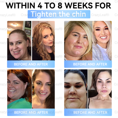 [Last Day Promotion 60% OFF] 💎Buildleaf® Tirzepatide Slimming & Health Nano Microneedle Patch 🇺🇸👩‍⚕️(Zero Pain, 24/7 Release | Lose 20lbs FAST | 90%Sugar DropI) (Copy)