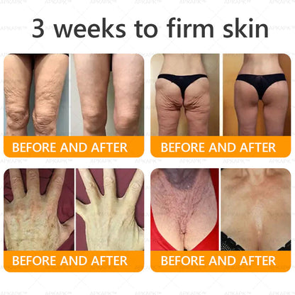 Clinically Proven Formula:✨ APKAPK® Bee venom Comprehensive Cream 🔥 Sagging Skin, Fine Lines, Loss of Firmness, Flat Bust, Drooping Hips, and More